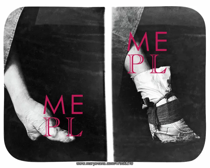 : Bound foot, China : Bound foot, China