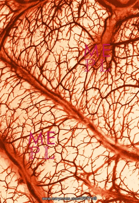 : Brain Arteries and Veins : Brain Arteries and Veins