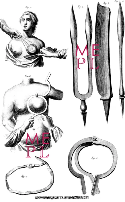 : Breast Surgery Instruments, 1772 : Breast Surgery Instruments, 1772