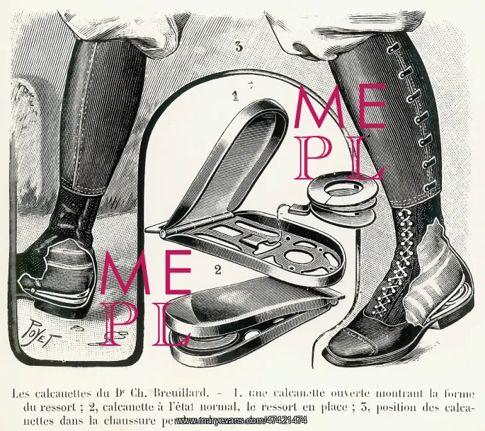 : Breuillard's device to assist walking : Breuillard's device to assist walking