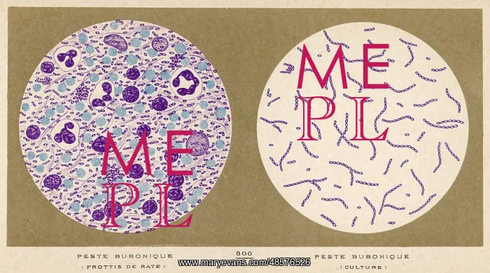 : Bubonic Plague Bacillus : Bubonic Plague Bacillus