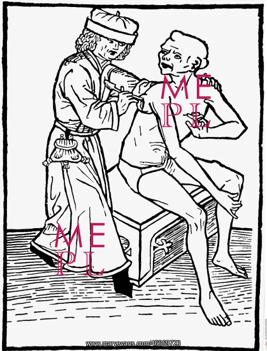 : Bubonic plague treated : Bubonic plague treated