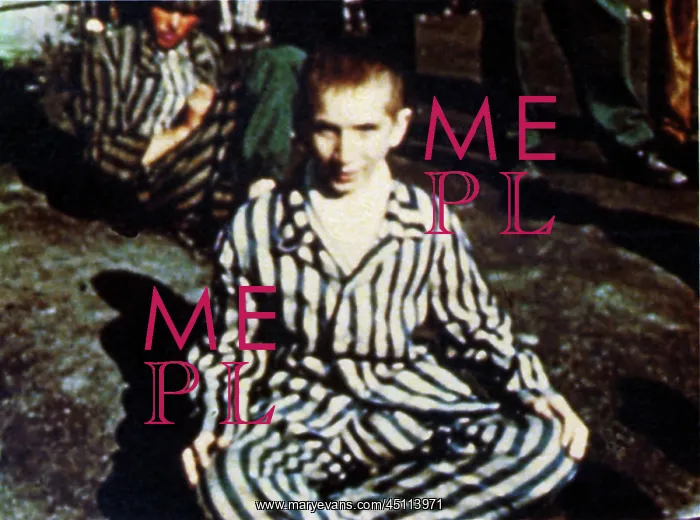 : Buchenwald - boy after liberation of the camp : Buchenwald - boy after liberation of the camp