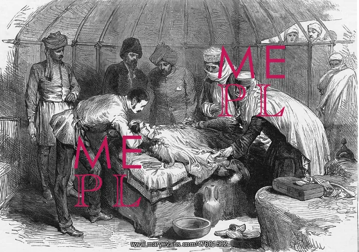 : Burn Surgery, 1885 : Burn Surgery, 1885