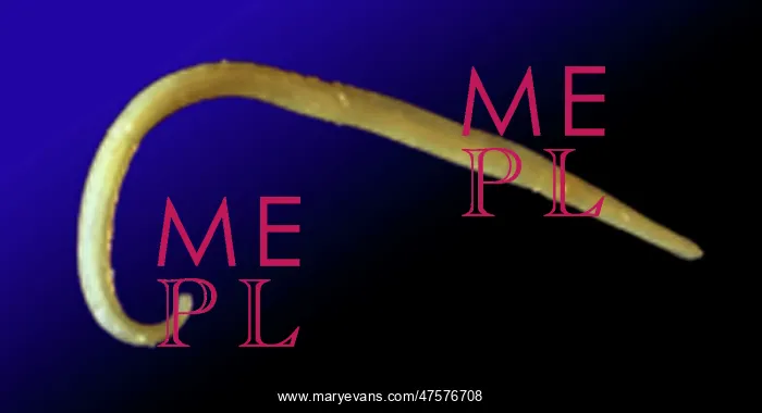 : Capillaria philippinensis, parasitic worm : Capillaria philippinensis, parasitic worm