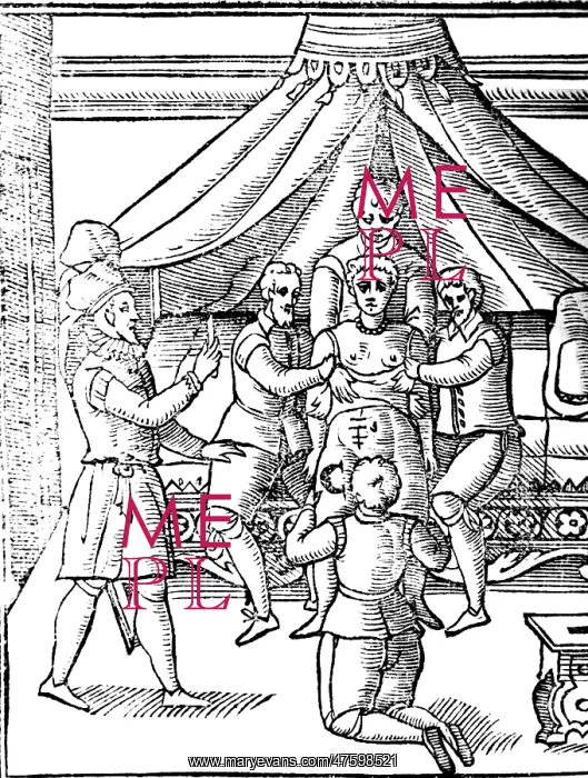 : Cesarean Section, 17th Century : Cesarean Section, 17th Century