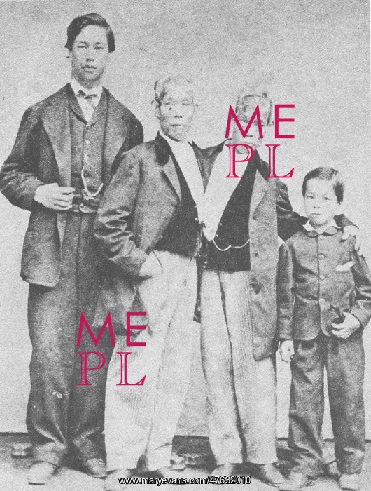 : Chang and Eng, Original Siamese Twins : Chang and Eng, Original Siamese Twins