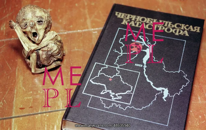 : Chernobyl abnormalities collection at Zhytomyr : Chernobyl abnormalities collection at Zhytomyr