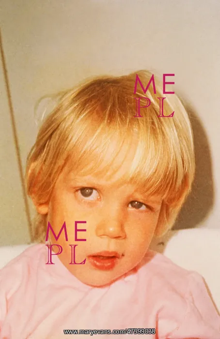 : Child with Bell's Palsy : Child with Bell's Palsy