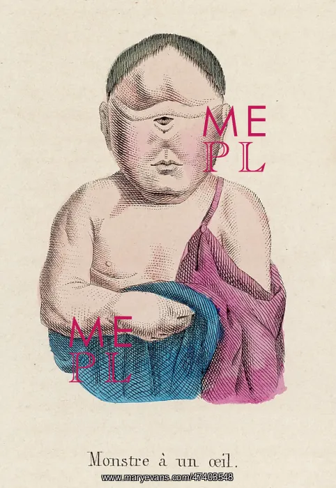  : CHILD WITH ONE EYE