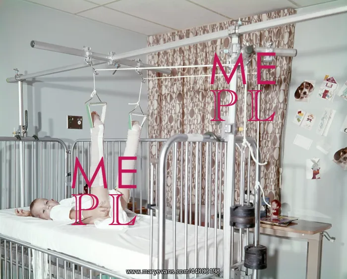  : Child In Traction Hospital Broken