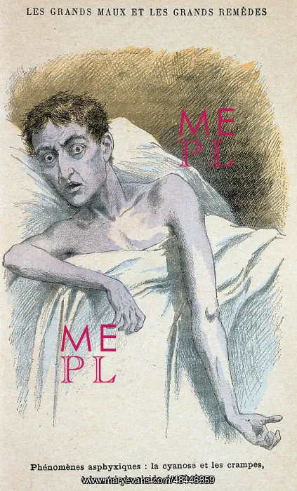 : Cholera: Patient in typical cholera attitude : Cholera: Patient in typical cholera attitude