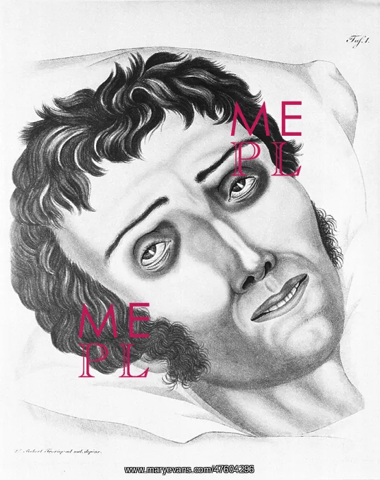 : Cholera Victim, 1831 : Cholera Victim, 1831