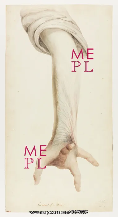 : Cicatrix of a Burn : Cicatrix of a Burn