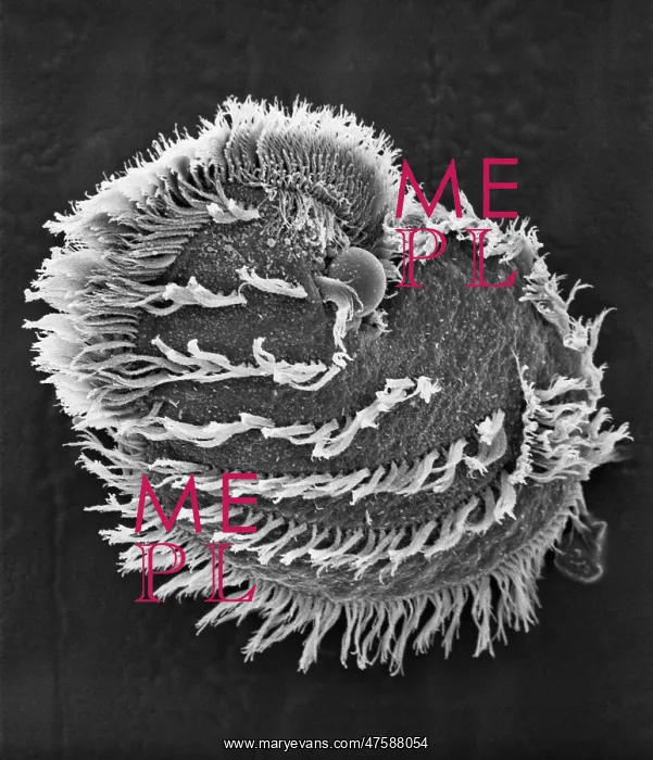 : Ciliate plankton : Ciliate plankton