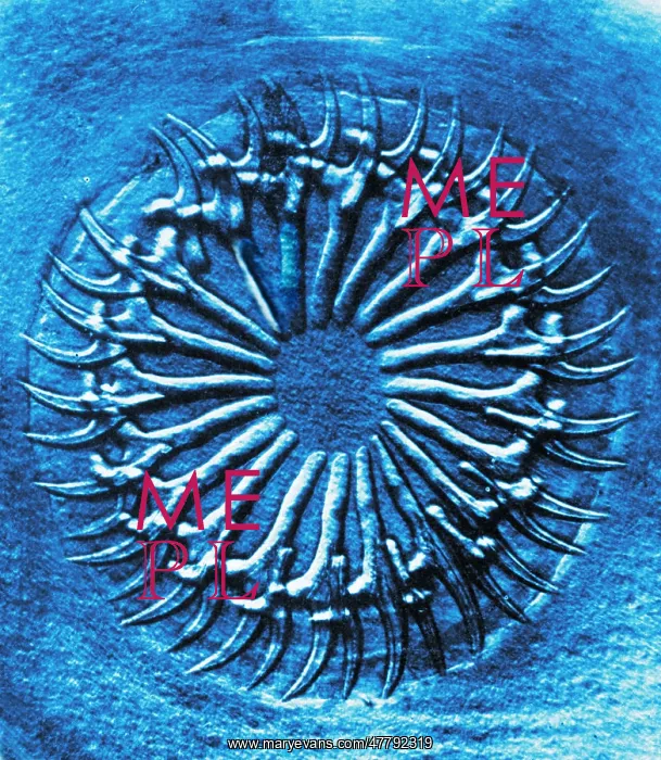 : Circlet of Hooks on Scolex, Early Photomicrograph : Circlet of Hooks on Scolex, Early Photomicrograph