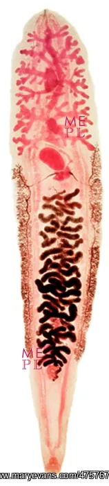 : Clonorchis sinensis, liver fluke : Clonorchis sinensis, liver fluke