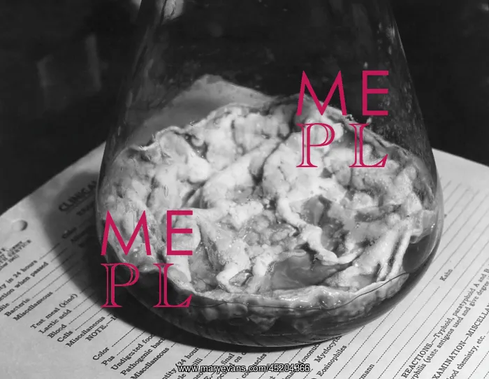 : Closeup of Penicillin mold in the bottom ? : Closeup of Penicillin mold in the bottom ?