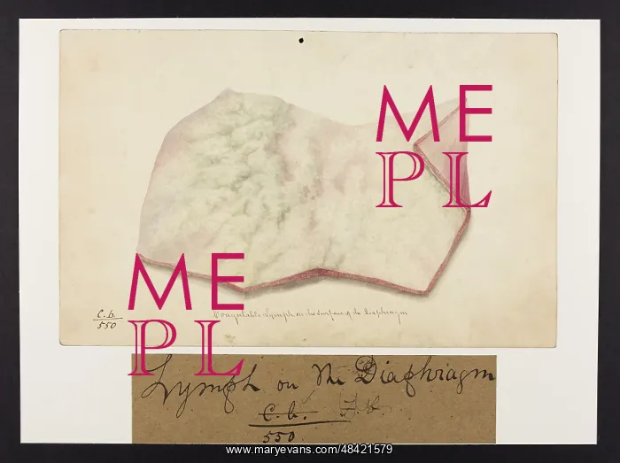  : Coagulable Lymph on the Diaphragm