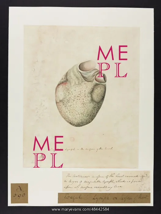 : Coagulable Lymph on Surface of Heart : Coagulable Lymph on Surface of Heart