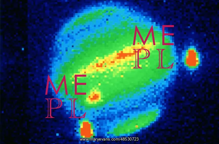  : Comet Shoemaker-Levy, 1994. Impact with Jupiter