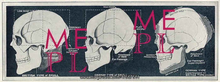 : Comparison of British & German skull shapes, WW1 : Comparison of British & German skull shapes, WW1