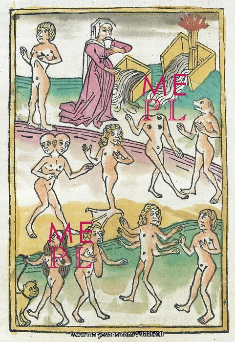 : Conrad of Megenberg, Deformities and Diseases, 15th Century : Conrad of Megenberg, Deformities and Diseases, 15th Century