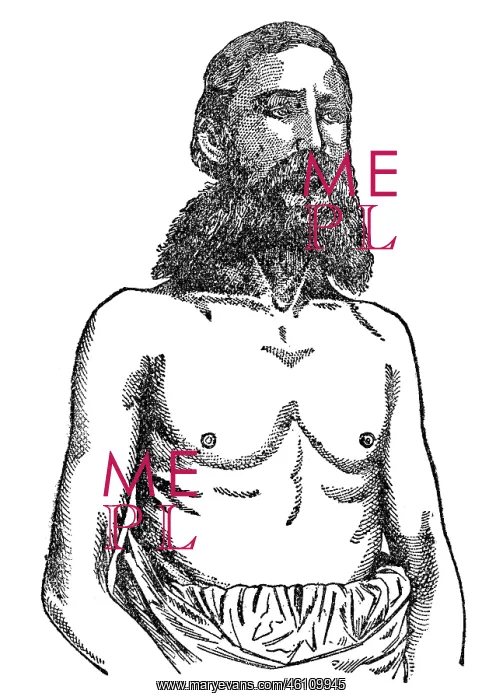 : Consumptive chest, 1902 : Consumptive chest, 1902