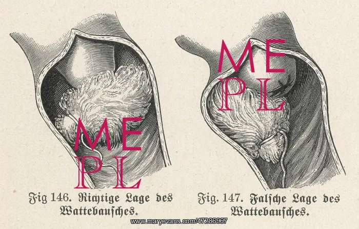 : CONTRACEPTION / 1905 : CONTRACEPTION / 1905