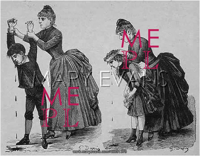 : COPING WITH NOSEBLEED : COPING WITH NOSEBLEED