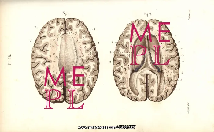 : Cross sections through the brain : Cross sections through the brain