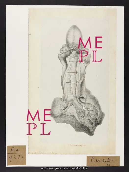 : Croup. Uncol. Lithograph - signed R.H. Nimmo's Lithog : Croup. Uncol. Lithograph - signed R.H. Nimmo's Lithog