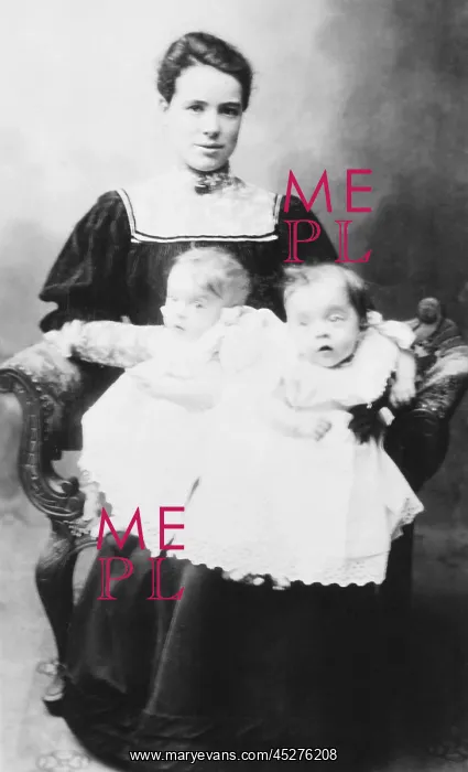 : Daisy Hilton and Violet Hilton, conjoined twins : Daisy Hilton and Violet Hilton, conjoined twins