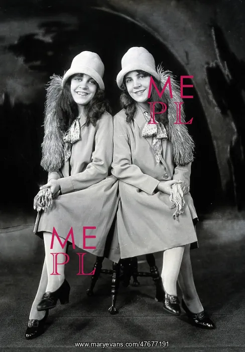 : Daisy and Violet Hilton, Conjoined Twins : Daisy and Violet Hilton, Conjoined Twins
