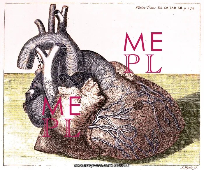 : Damaged Heart of George II, 1761 : Damaged Heart of George II, 1761