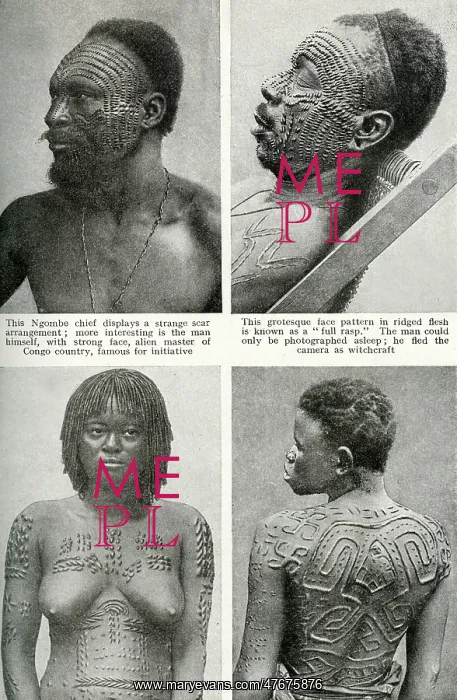  : Decorative scarring, Belgian Congo, Central Africa