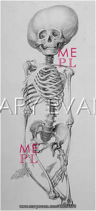  : Deformed human skeleton