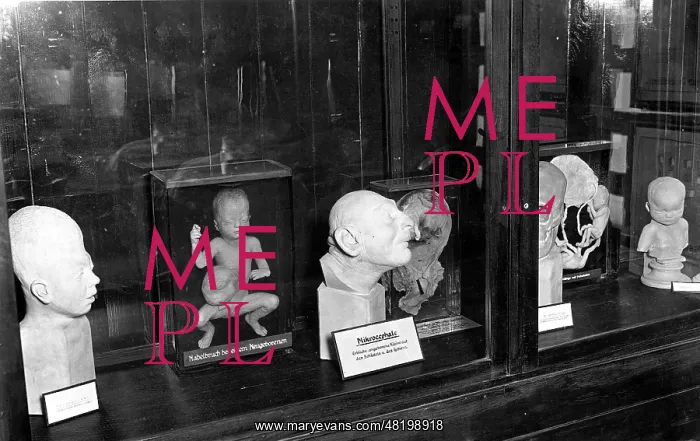 : Deformities exhibited in the Exhibit of Genetics and Eugeni : Deformities exhibited in the Exhibit of Genetics and Eugeni