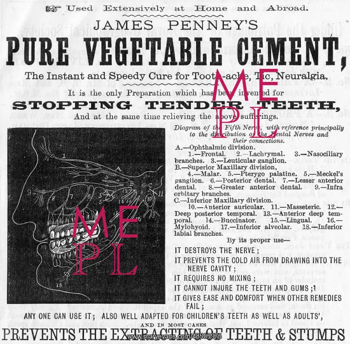 : Dental advert, Pure Vegetable Cement : Dental advert, Pure Vegetable Cement