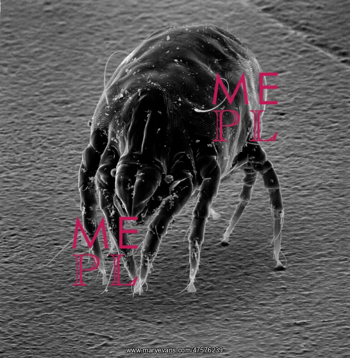 : Dermatophagoides sp. dust mite : Dermatophagoides sp. dust mite