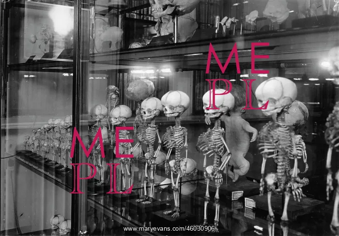 : Development of the human skeleton : Development of the human skeleton
