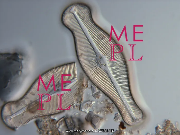 : Diatom, Didymosphenia geminata, LM : Diatom, Didymosphenia geminata, LM