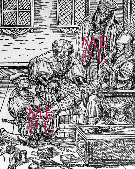 : Die Amputation - The Amputation, 1500 : Die Amputation - The Amputation, 1500