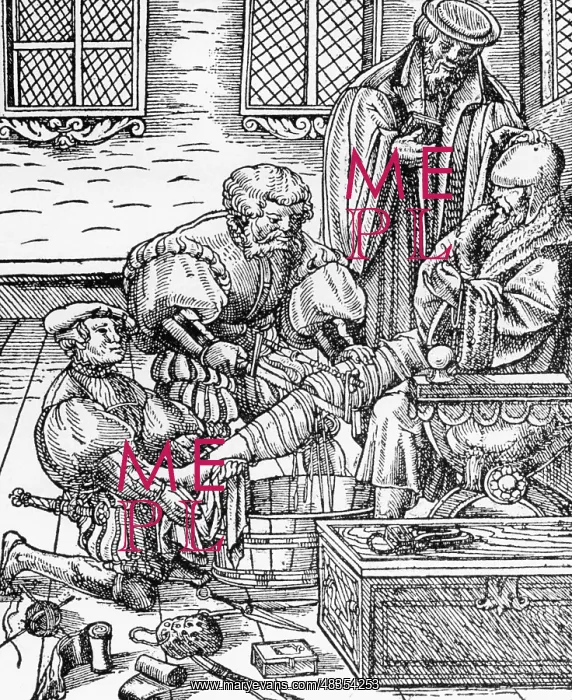 : Die Amputation - The Amputation, 1500 : Die Amputation - The Amputation, 1500