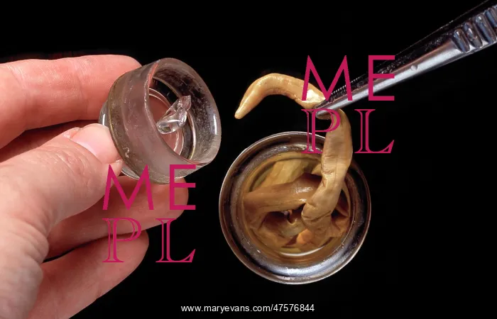 : Dioctophyme renale, giant kidney worm : Dioctophyme renale, giant kidney worm