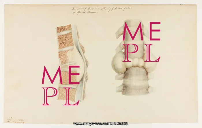 : Disease of the Spine : Disease of the Spine