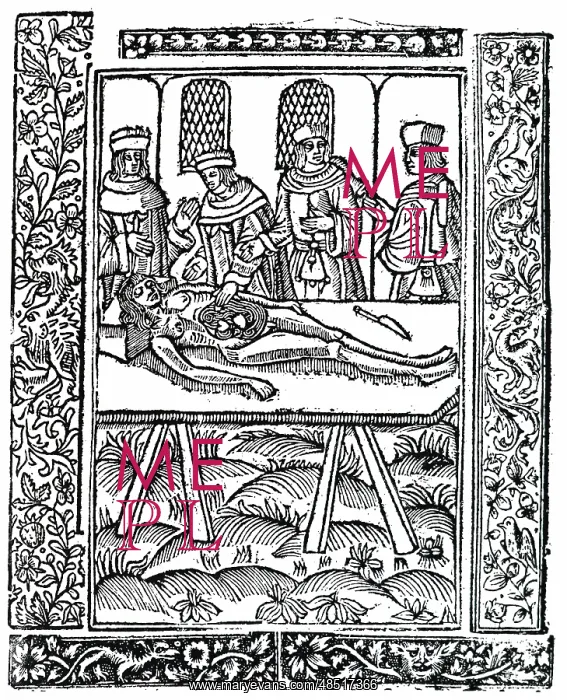  : A dissection. From an early 16th century woodcut