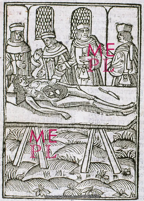: A dissection in progress. From Le livre de la : A dissection in progress. From Le livre de la
