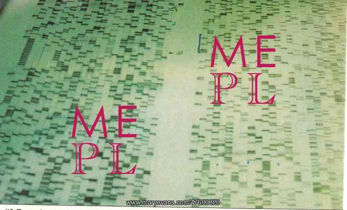: DNA Sequencing Gel : DNA Sequencing Gel