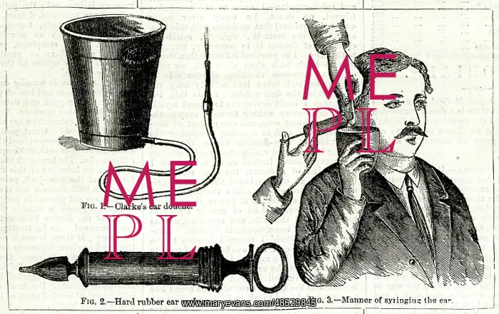  : Doctor syringing a patient's ear